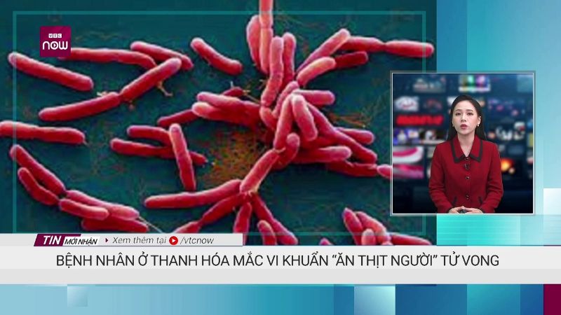 Tin đưa về bệnh vi khuẩn ăn thịt người